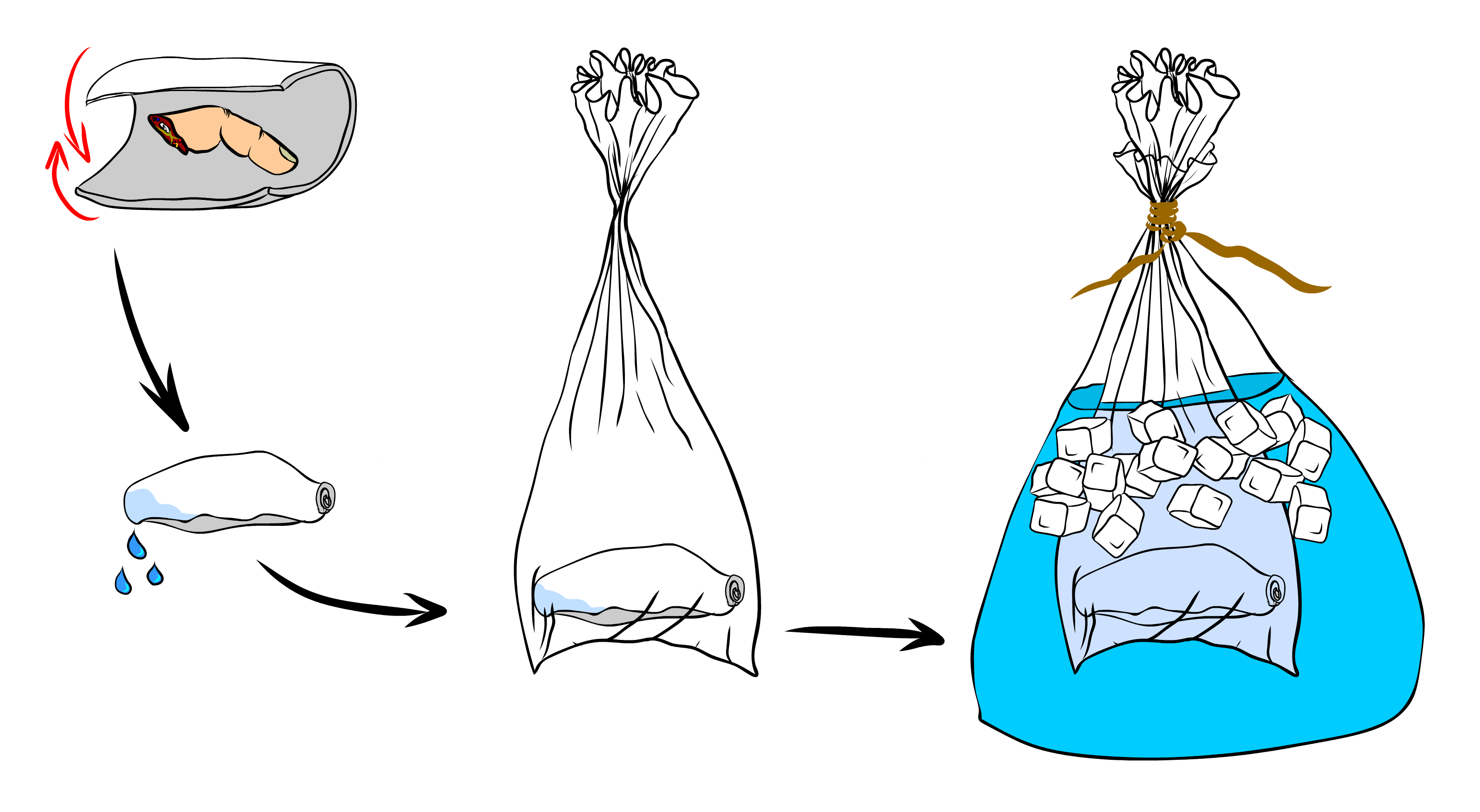 Správné uchování amputátu