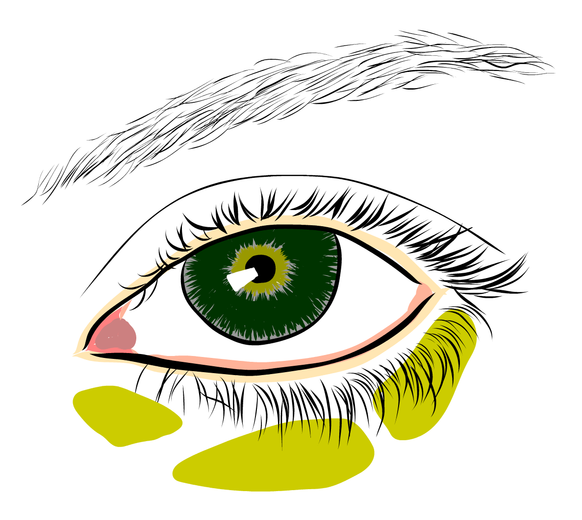 Umístění ložisek tuků dolních víček