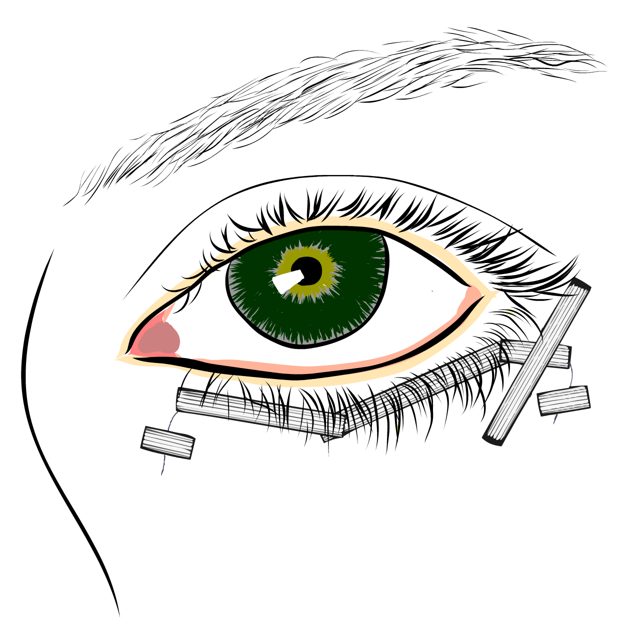 Operace dolních víček - náplasti