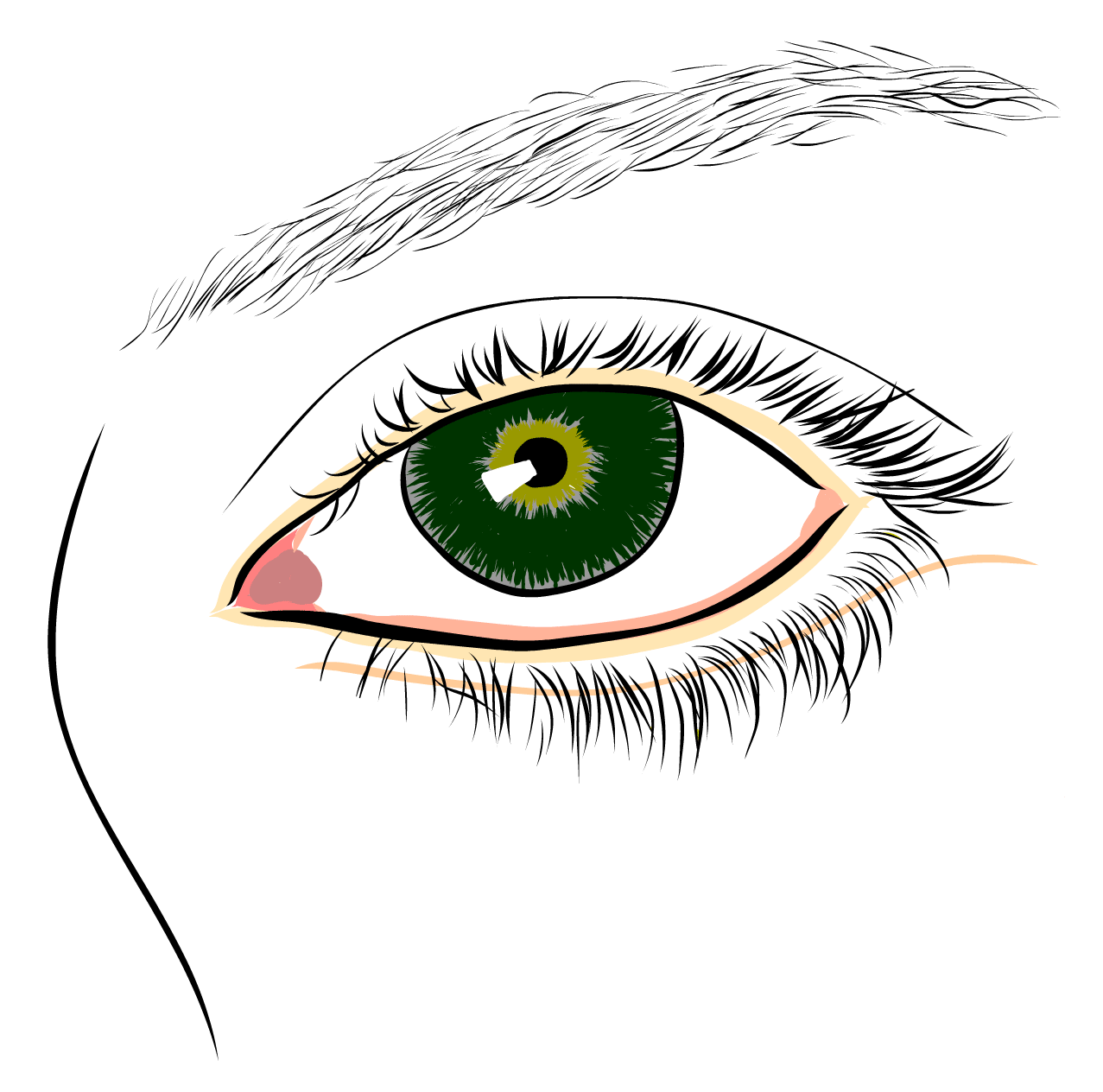 Operace dolních víček - jizva