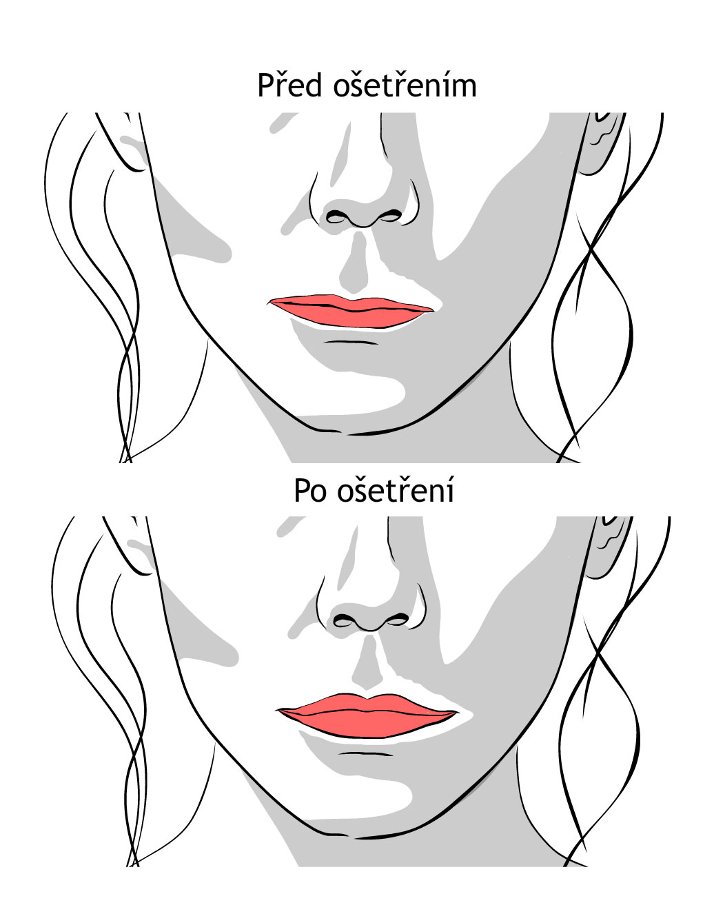 Zvýraznění kontur rtů