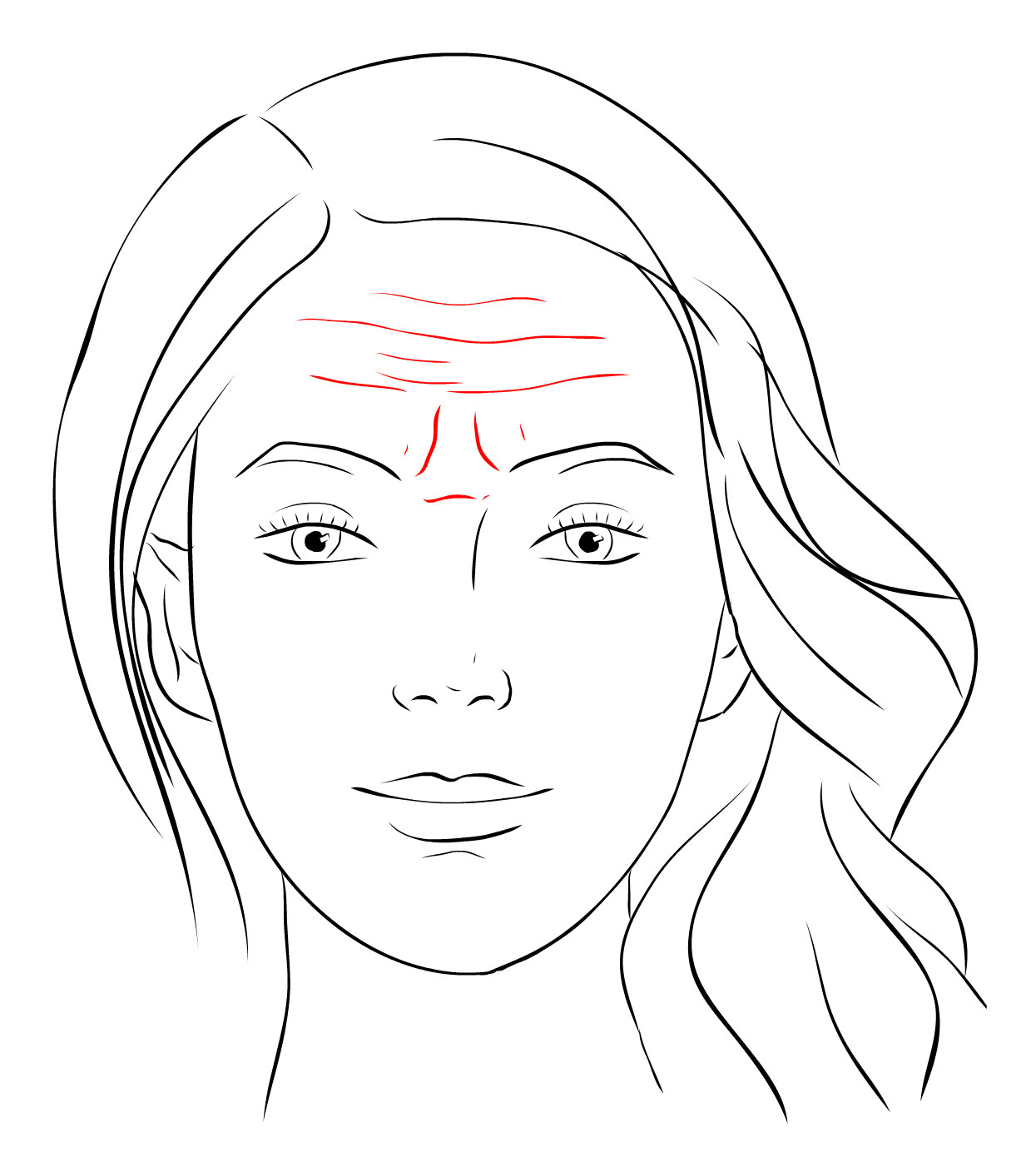 Vyhlazení jemných i hlubších vrásek čela a glabelly